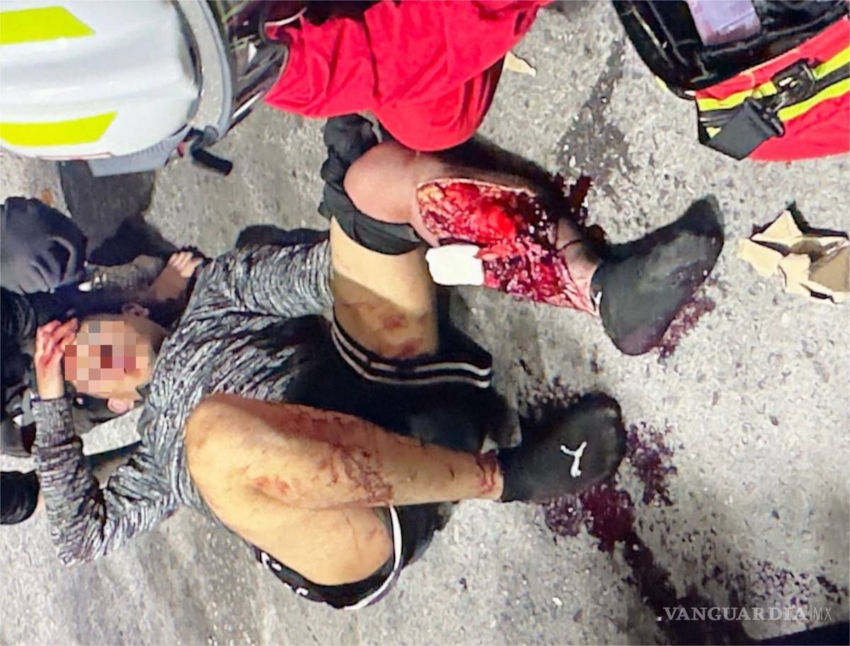 $!El joven presentó una grave lesión tras caer al asfalto.