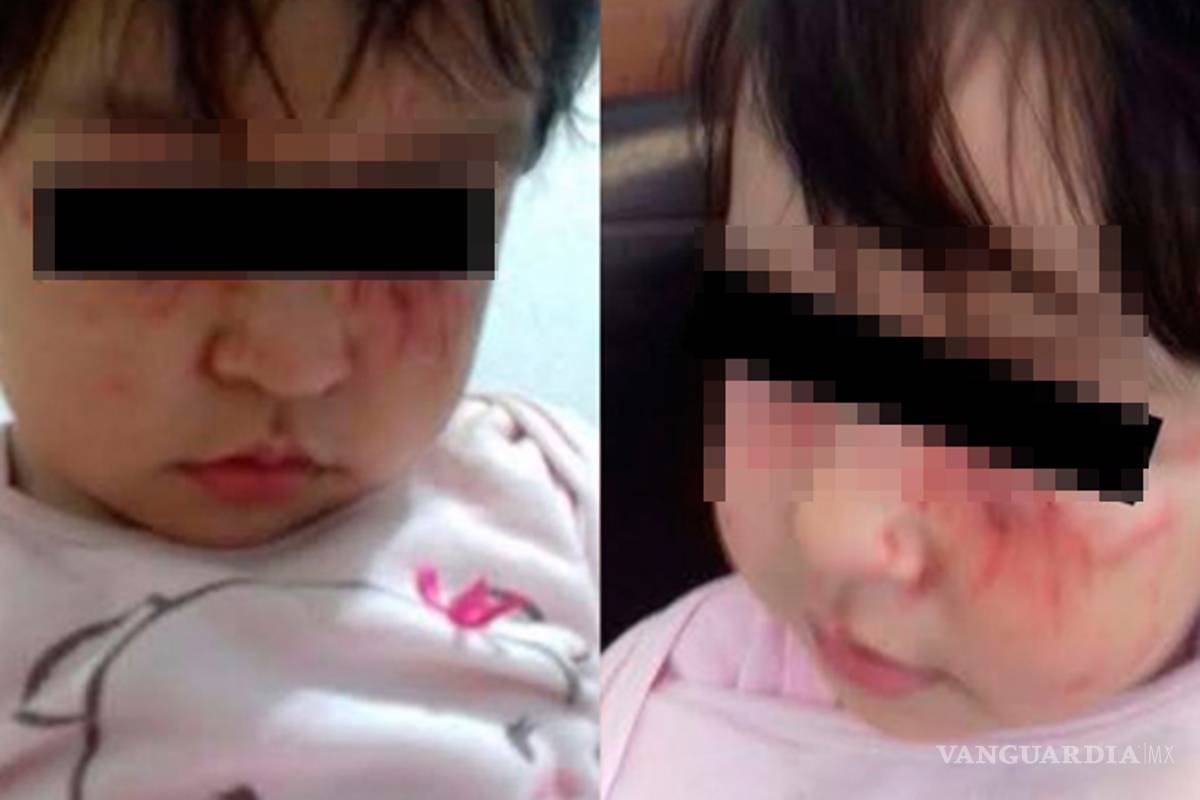 Denuncian maltrato a niña en estancia infantil de Morelia