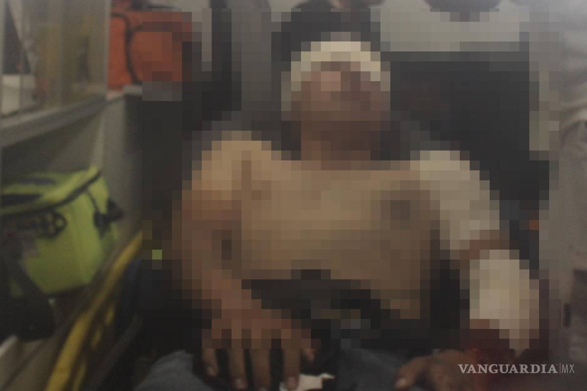 Huye auto blanco dejando a jóvenes motociclistas heridos al sur de Saltillo