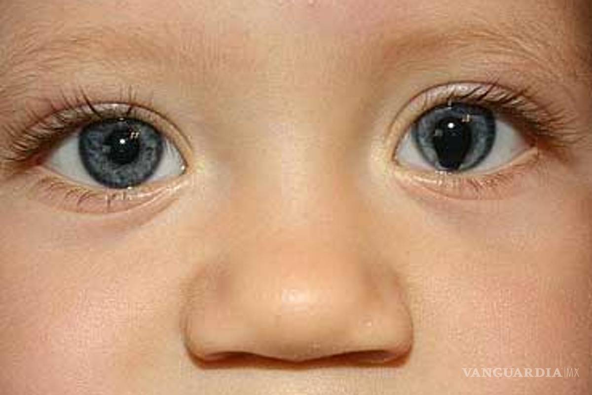 ¿Sabías de las enfermedades raras? Conócelas, hoy es su día