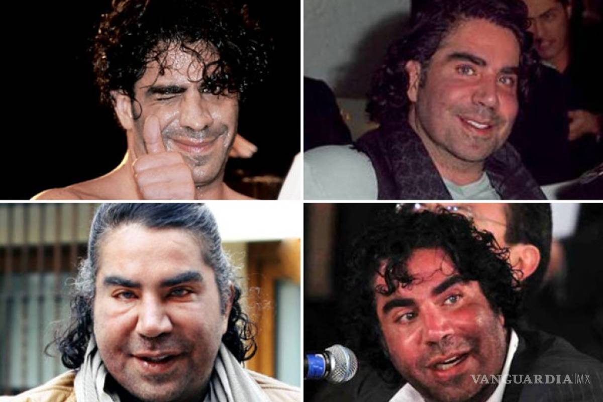 $!No solo es la Guzmán; estas celebridades quedaron peor con sus cirugías