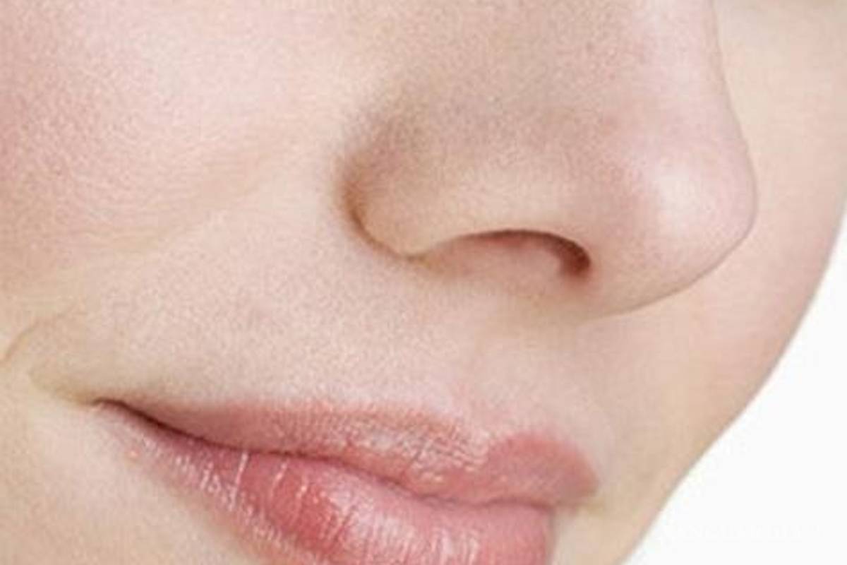 Antes de una cirugía de nariz, lo que hay que saber