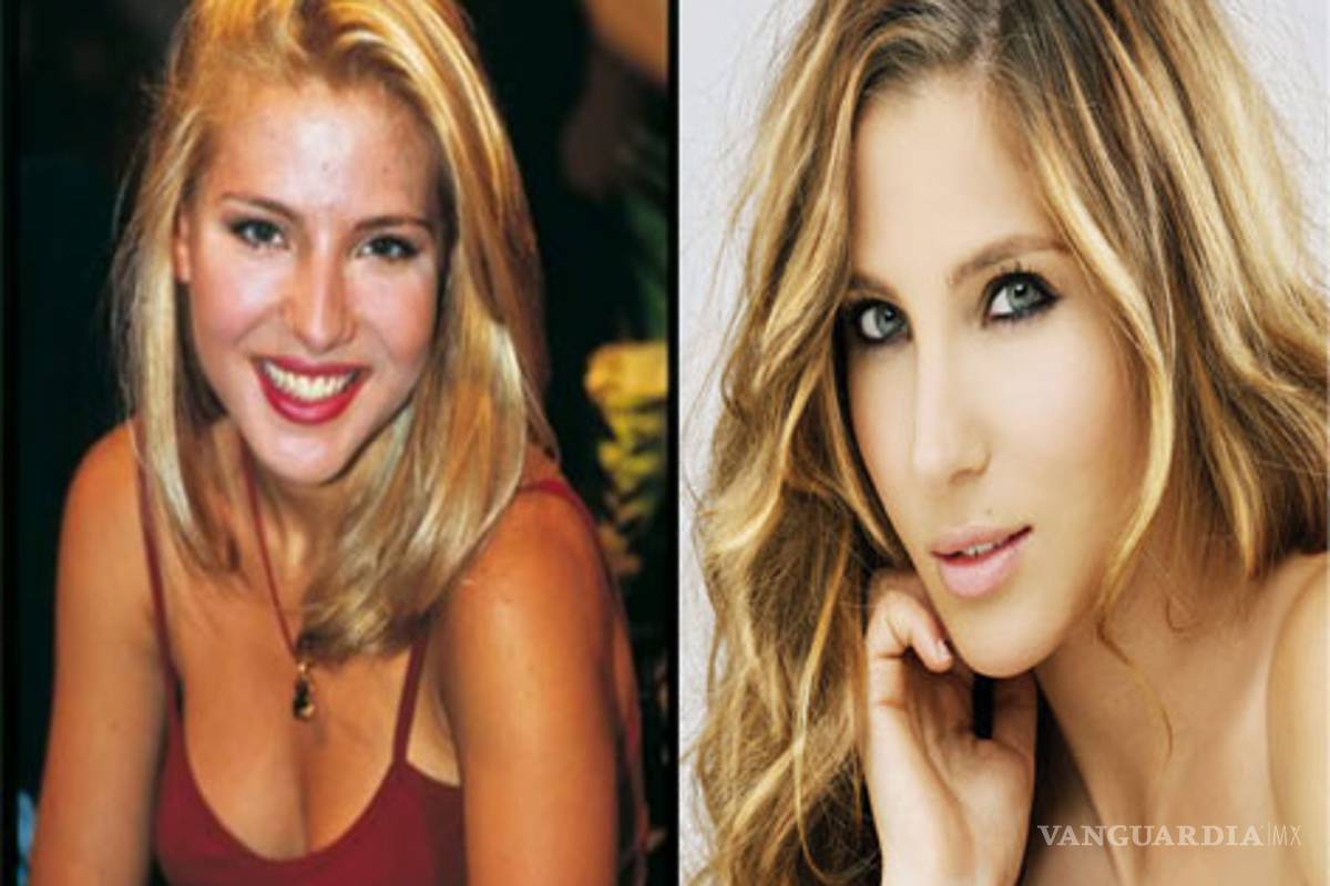 Desnudan a Elsa Pataky antes y después de la cirugía