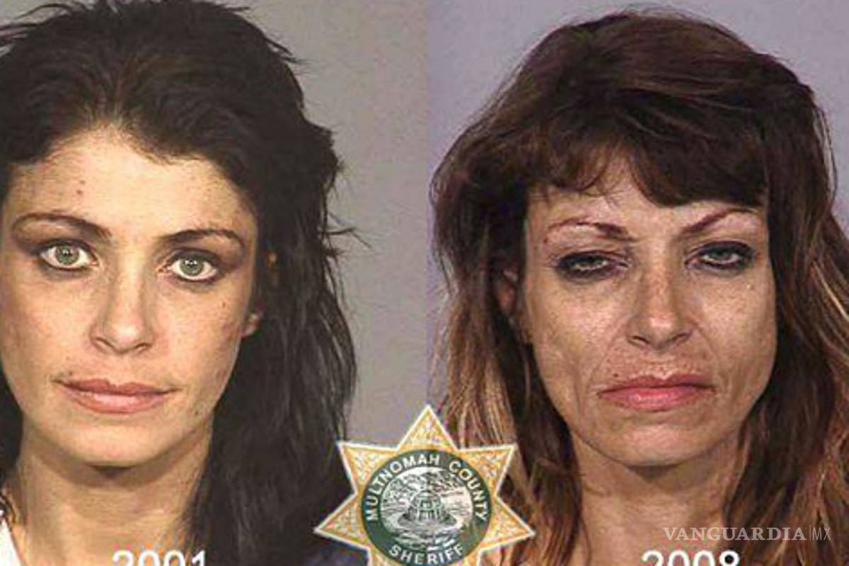 La cara de la droga: Fotos del antes y después del consumo de metanfetaminas
