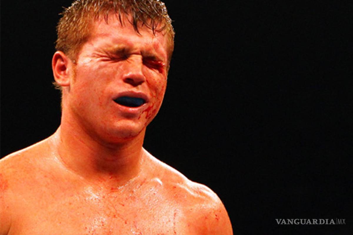 Un botín llamado Saul &quot;Canelo&quot; Alvarez; el peleador de &quot;relleno&quot; de Golden Boy Promotions