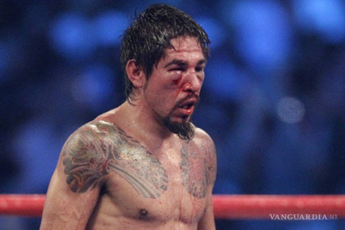 Margarito será operado del ojo tras la pelea ante Pacquiao