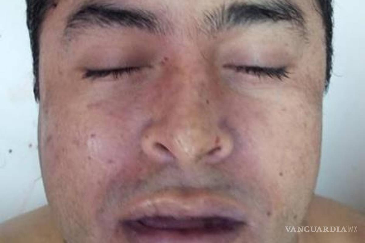 El cadáver exhibido &quot;no es del Lazca&quot;: Expertos en criminalística