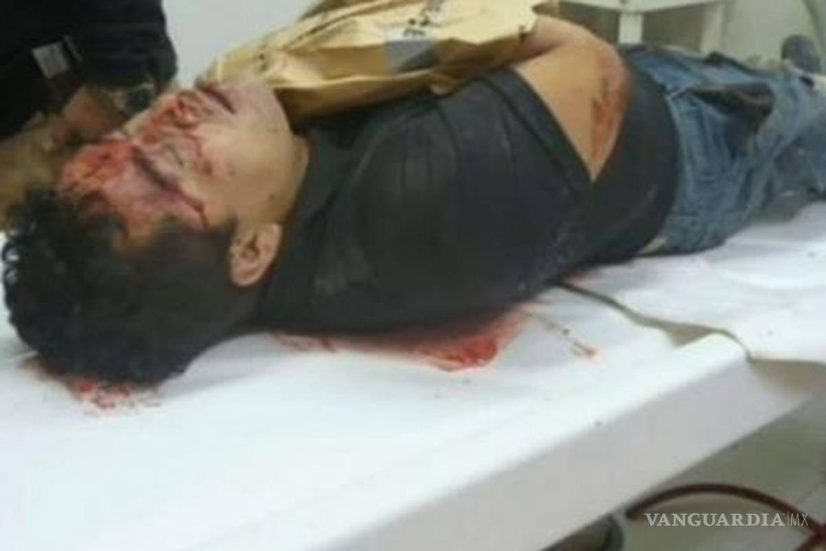 Univisión filtra nuevas fotografías del cuerpo de "El Lazca" antes de que comando se lo robara