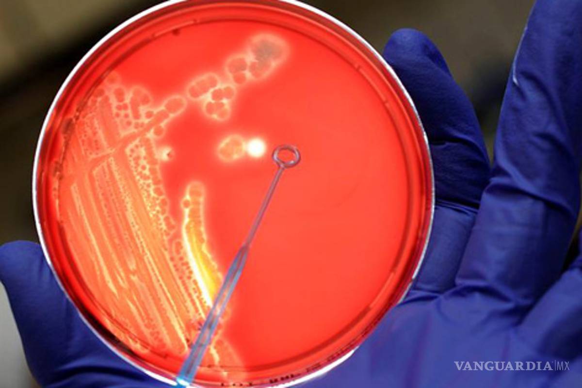 Entérate ¿Qué es la bacteria E. Coli?