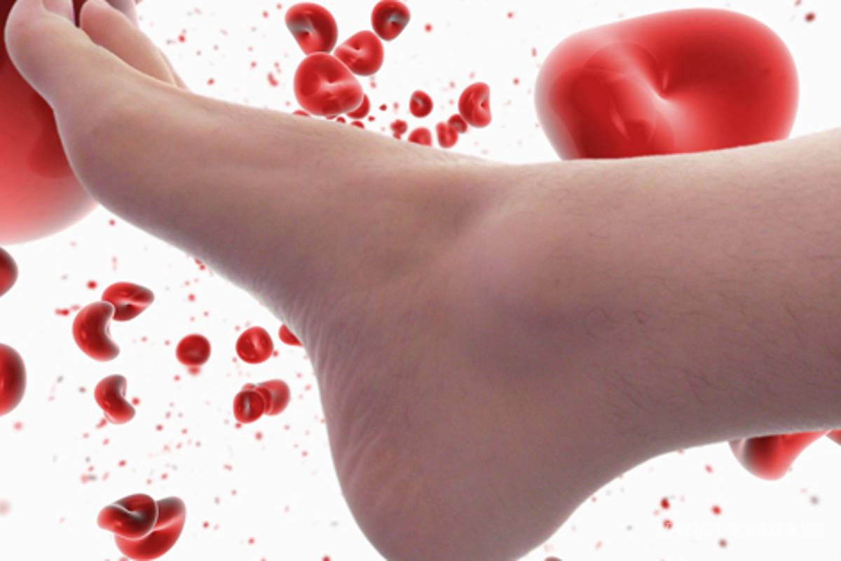 Diseñan mexicanos escáner que detecta falta de flujo sanguíneo