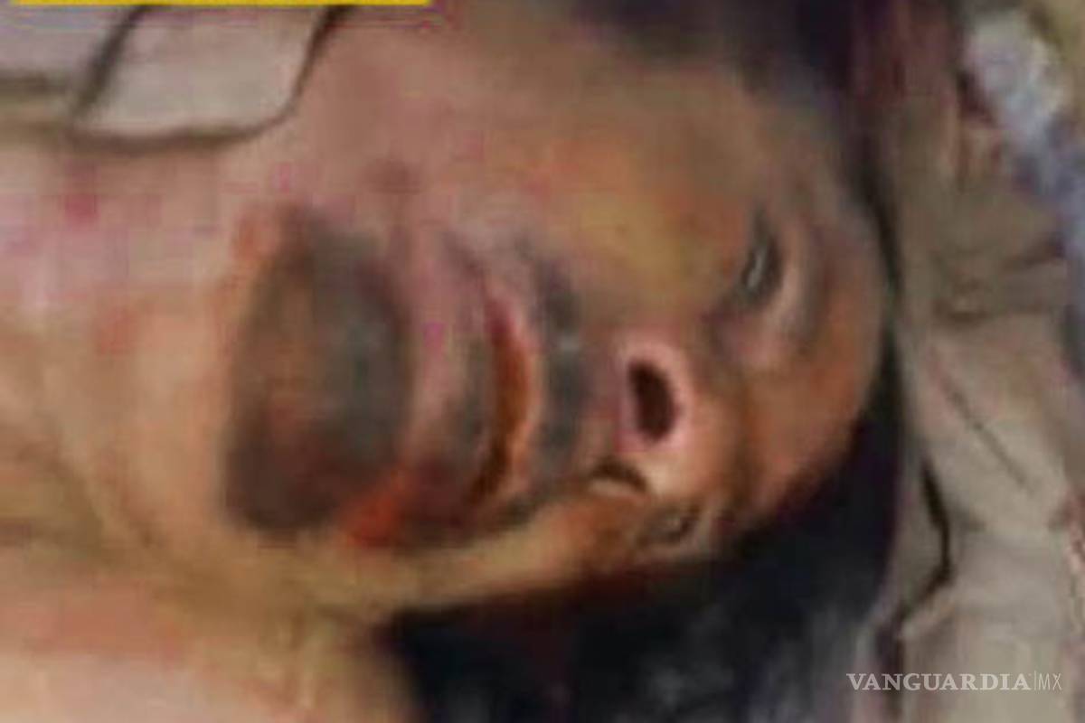 Autopsia indica que Gadafi murió por disparo en la cabeza