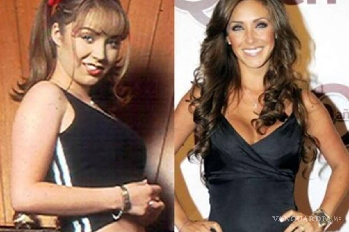 El nuevo rostro de Anahí y su historial de cirugías