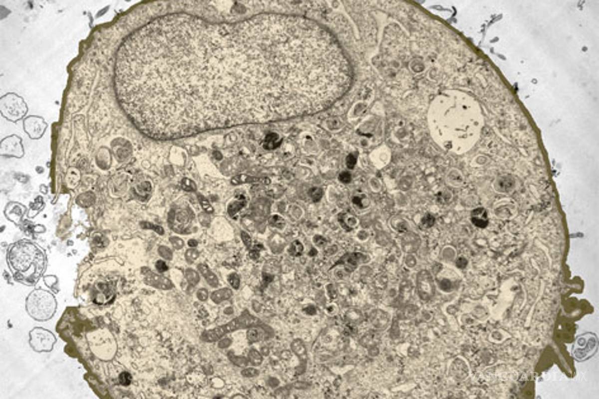 Alertan drástico aumento de cáncer en el mundo