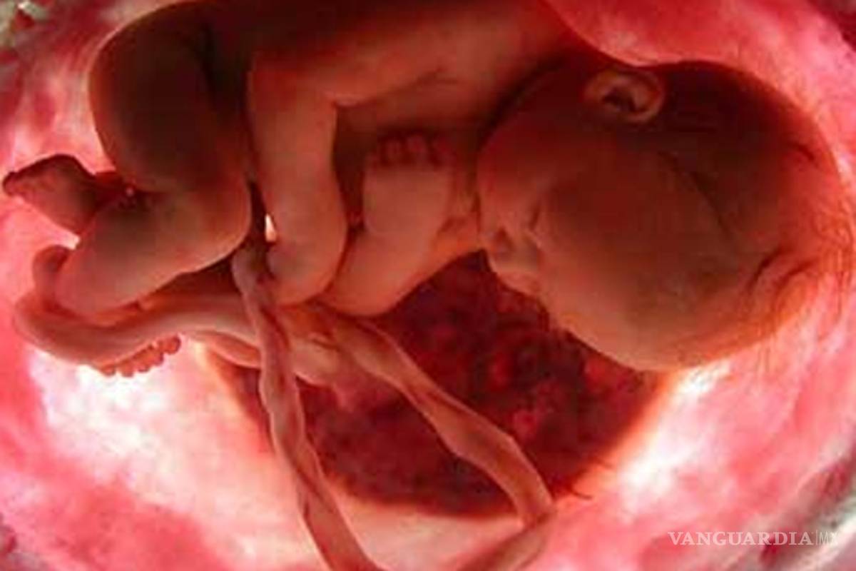 Cardiopatía congénita, segunda causa de muerte en menores de un año