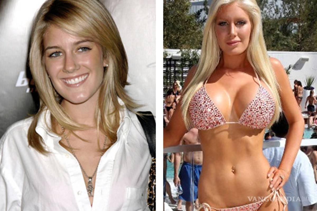 Heidi Montag, arrepentida de sus cirugías