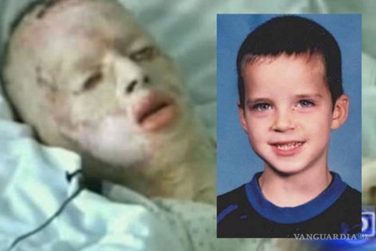 Niño fue violado y quemado a los 8 años, antes de morir revela quién lo agredió