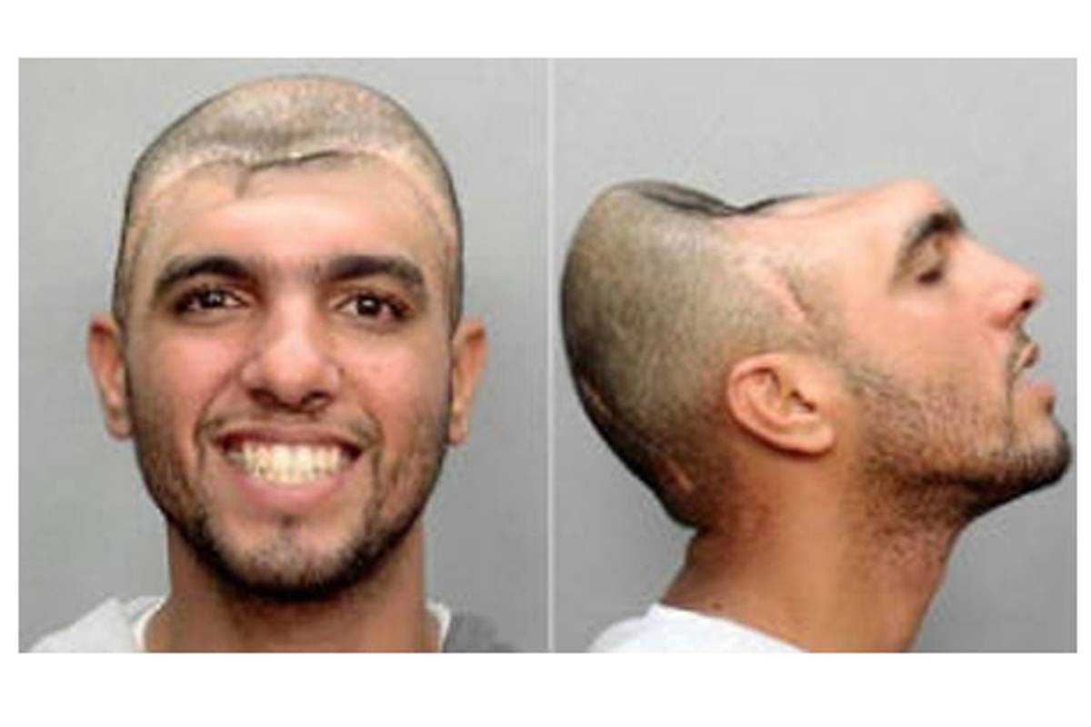 Un hombre con media cabeza abre su propio canal de videos