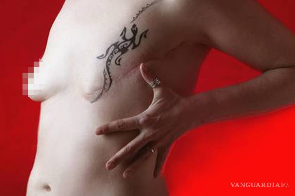 &quot;La mastectomía hace a la mujer asumir su cuerpo a partir de la castración, sin perder su femineidad&quot;