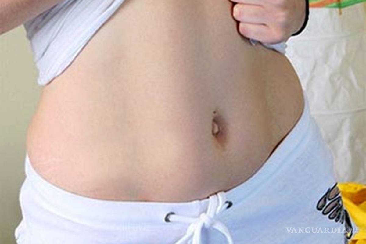 ¿Qué alimentos nos provocan gases?