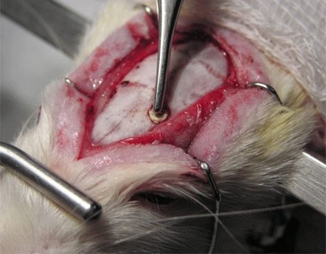 Científicos mexicanos reducen tumores cerebrales con nanotecnología