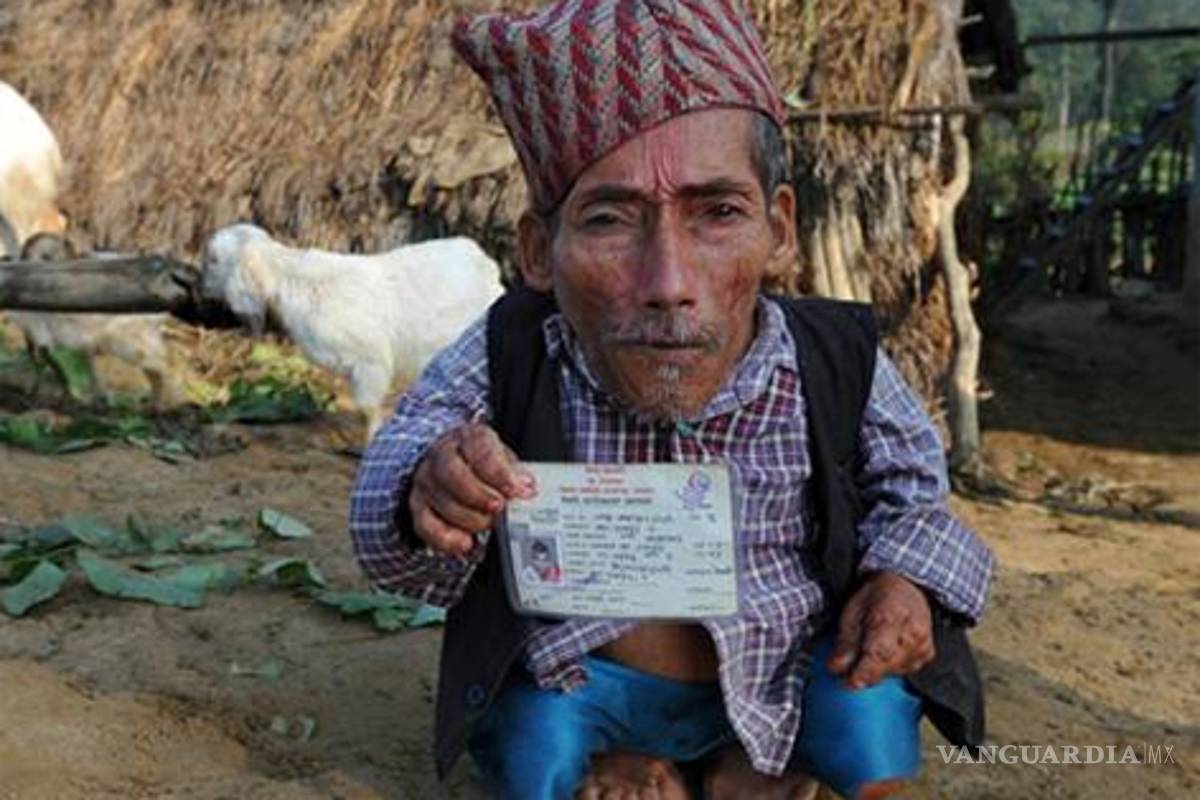 Nepalí dice ser el enano más pequeño del mundo