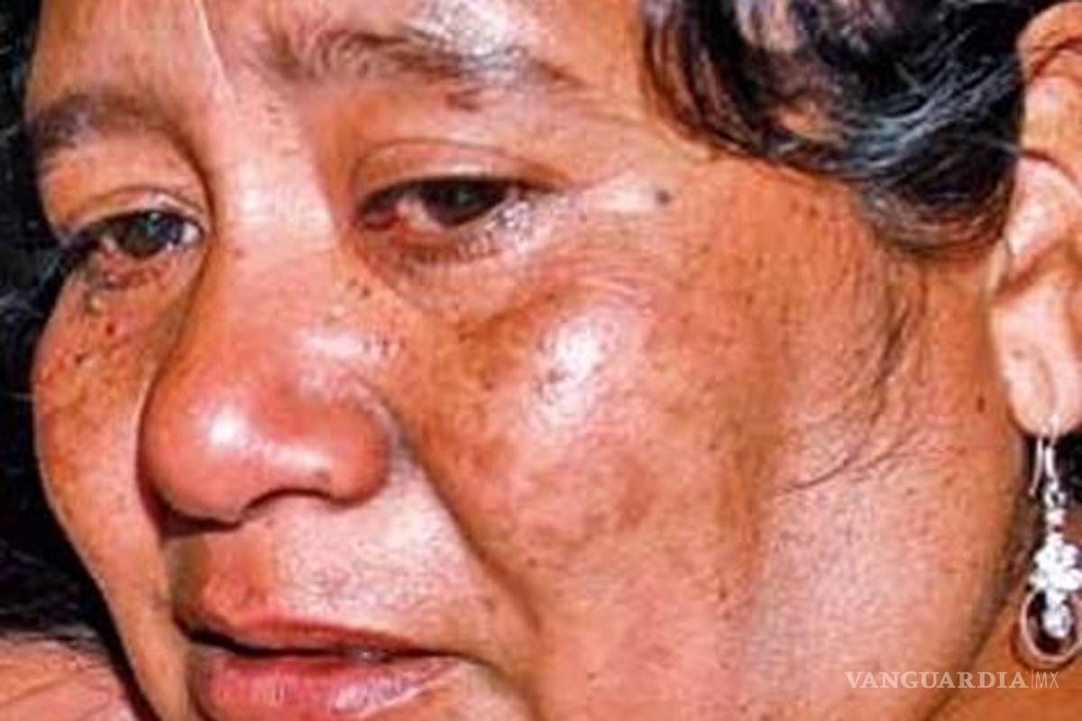 Juventina, un caso más del sistemático exterminio de defensores de bosques