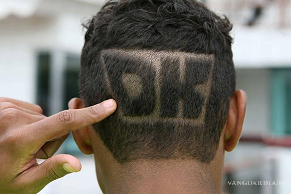 Células madre contra la alopecia