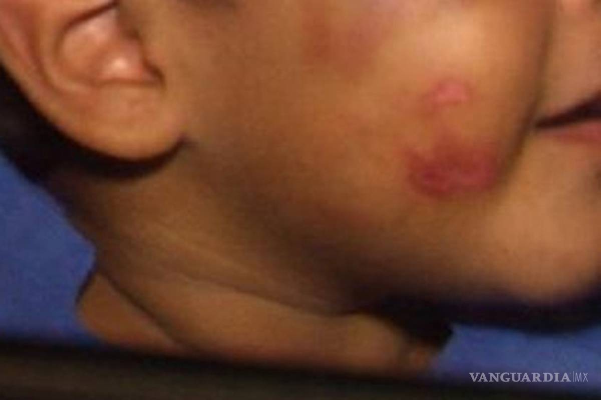 En México padecen violencia 60% de menores de 14 años, revela la CNDH