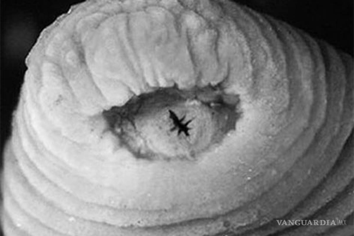 Descubren nueva especie de gusano en la nariz de una niña