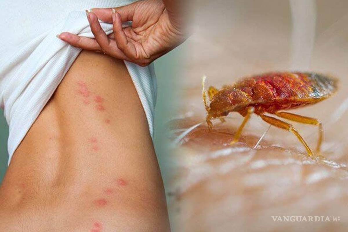 Alerta por plaga de chinches... ¿Cómo saber si te picó y qué debes hacer?