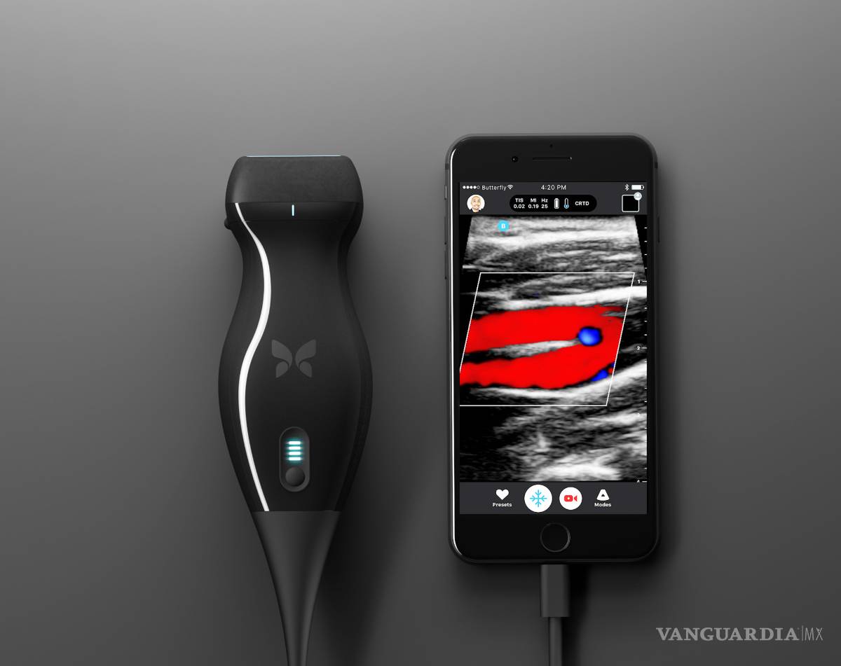 $!Con Butterfly iQ ya puedes ver tus ecografías desde tu celular