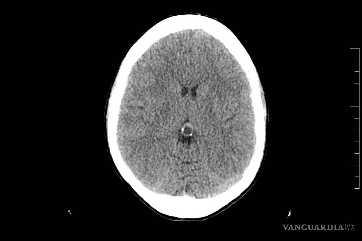 El niño se dibujaba con puntos en la cabeza: La inocente manera de representar su problema