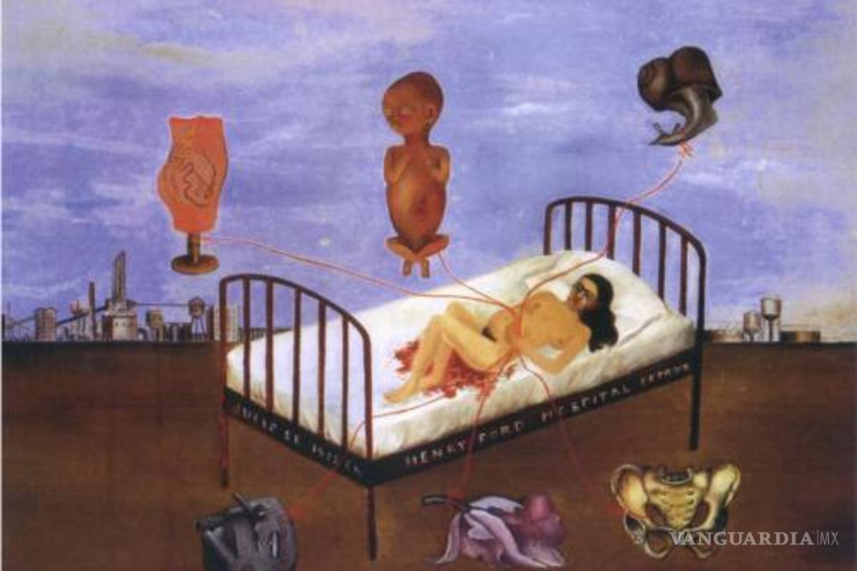 $!Frida Kahlo y sus trágicos accidentes que no conocías