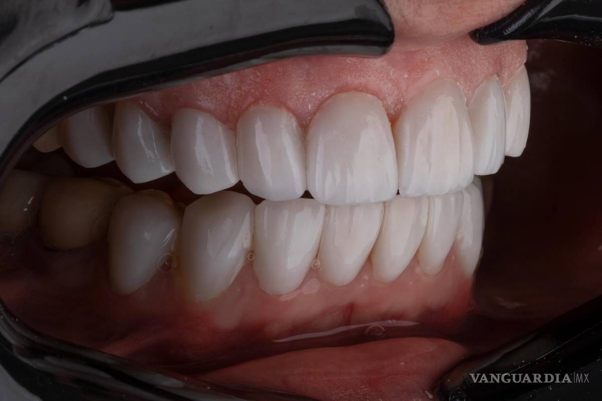 $!La enfermedad periodontal está asociada a una serie de problemas de salud como la diabetes, cardiopatías, infecciones respiratorias y demencia.