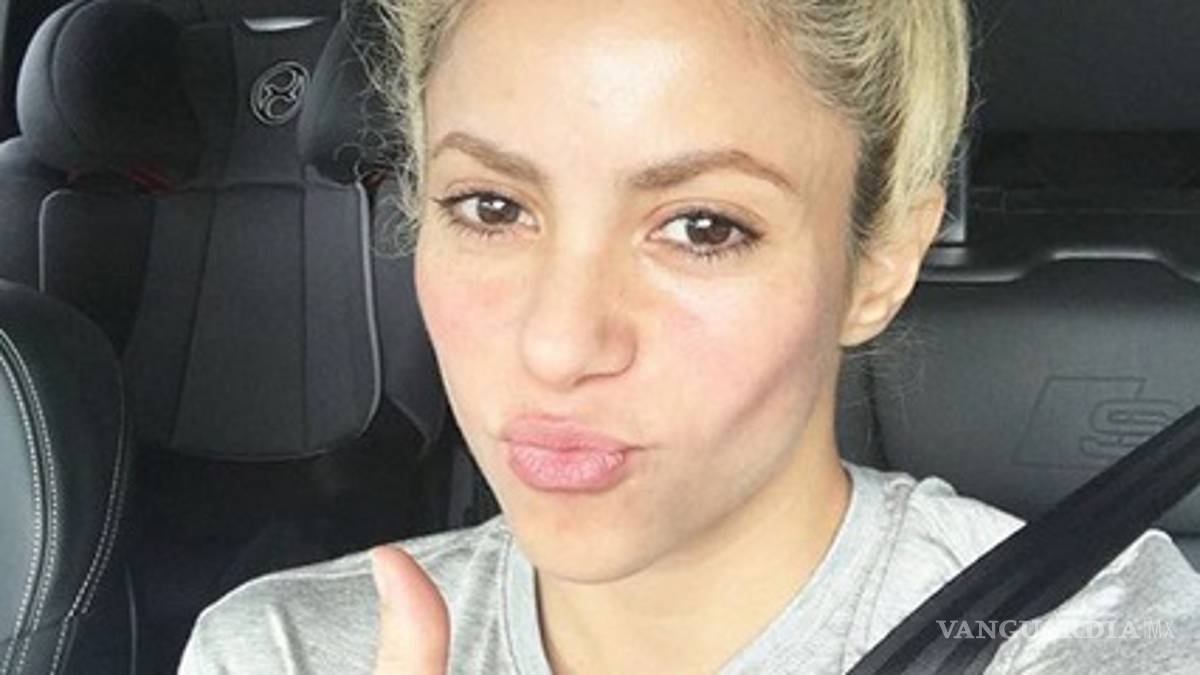 Shakira podría quedarse calva