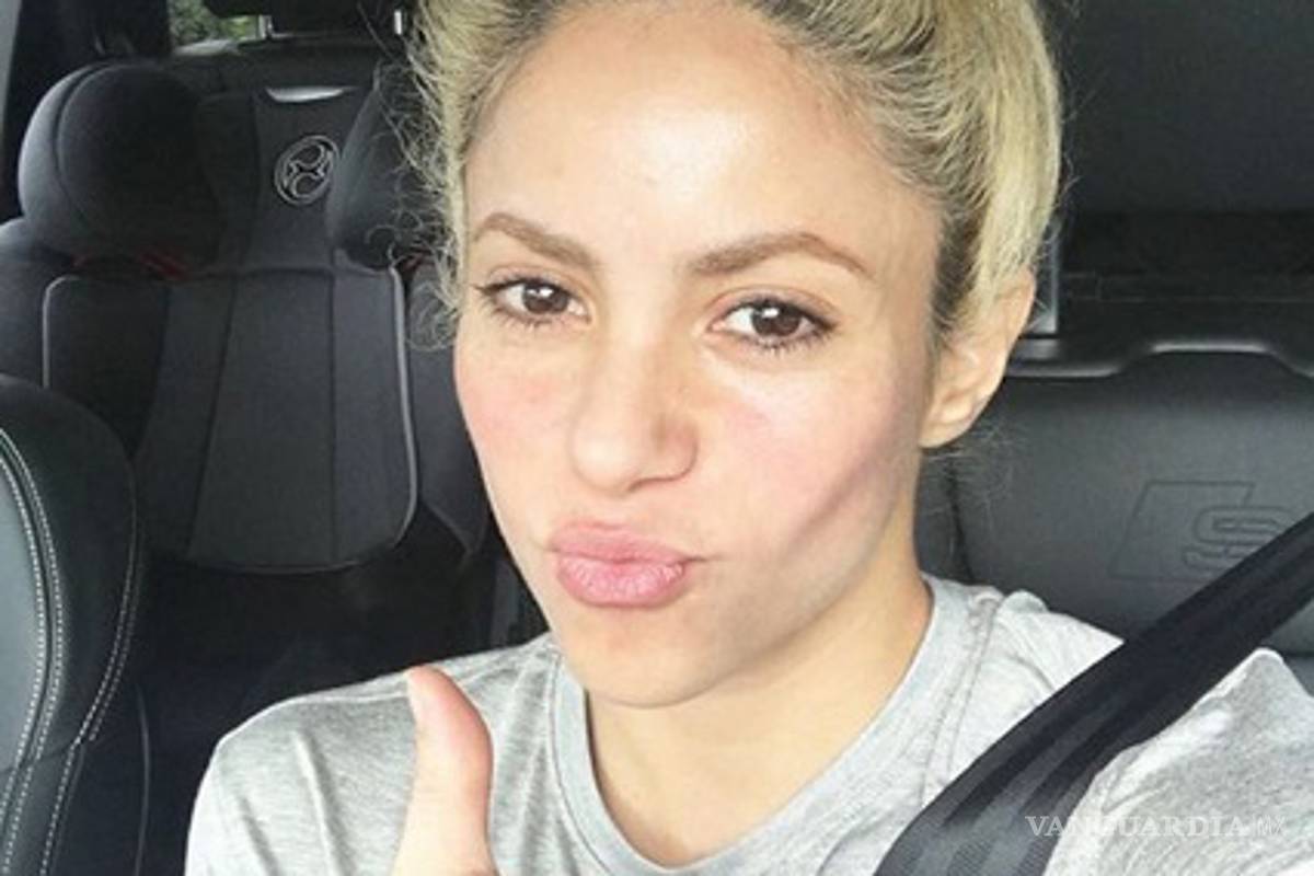 Shakira podría quedarse calva
