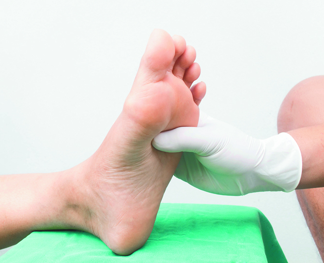 Durante clima gélido aumenta en IMSS consultas para diabéticos por pie de riesgo