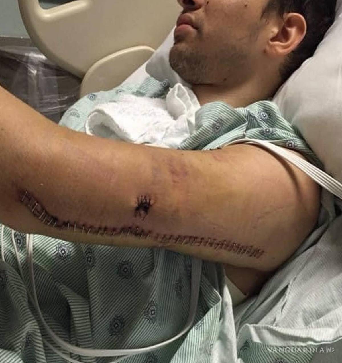 $!Fotografía cedida por Jorshua Hernández que lo muestra durante su recuperación en el hospital tras el tiroteo de la discoteca Pulse en Orlando, Florida.