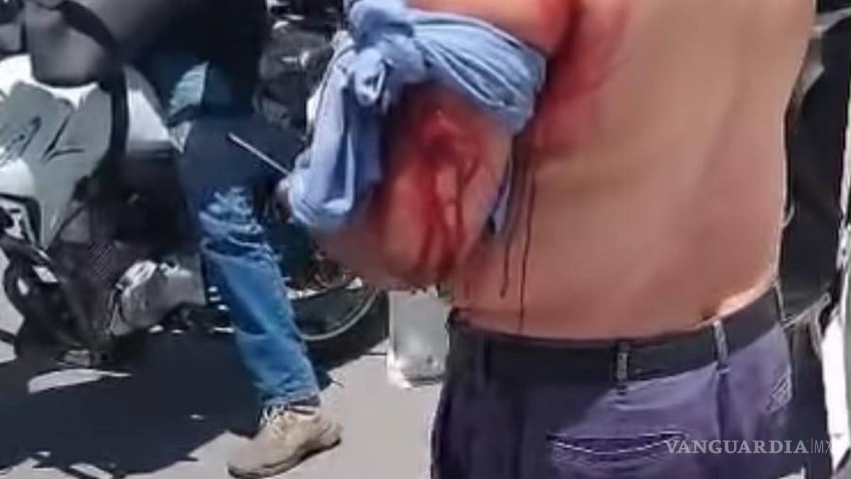 Apuñalan a chofer de aplicación, en Saltillo