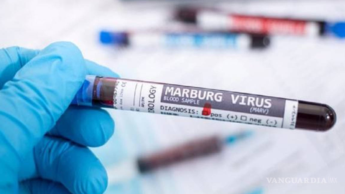 Confirman primera muerte por virus de Marburgo; ‘debemos detenerlo en seco’, alerta la OMS