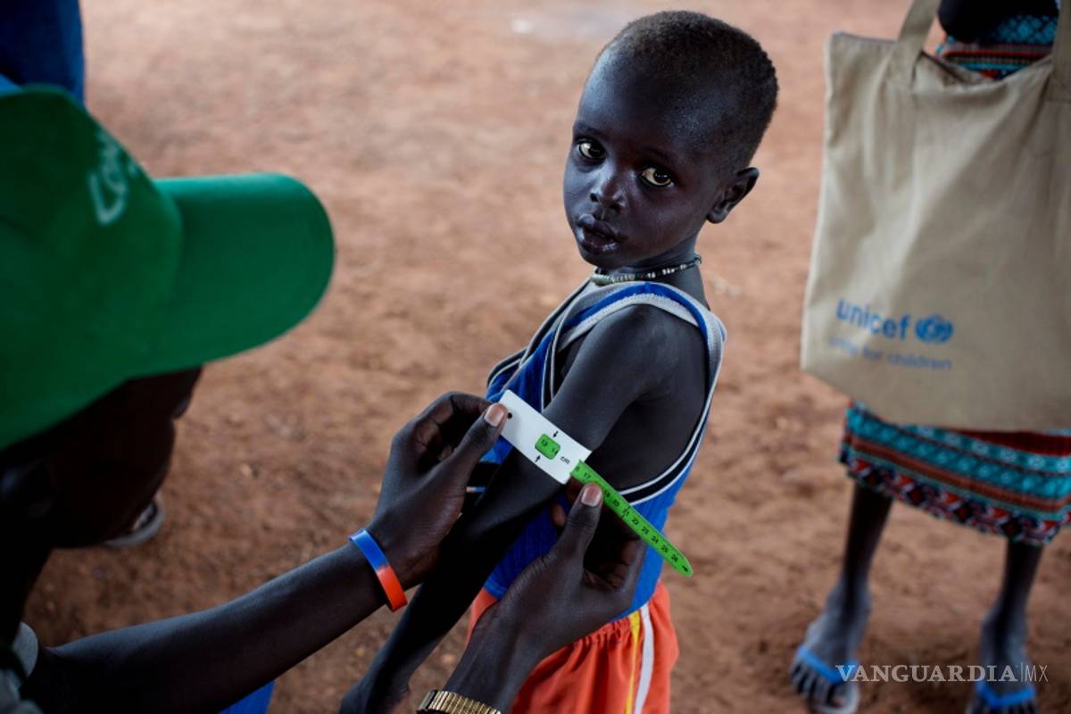 Unicef: Casi 1.4 millones de niños amenazados por la hambruna