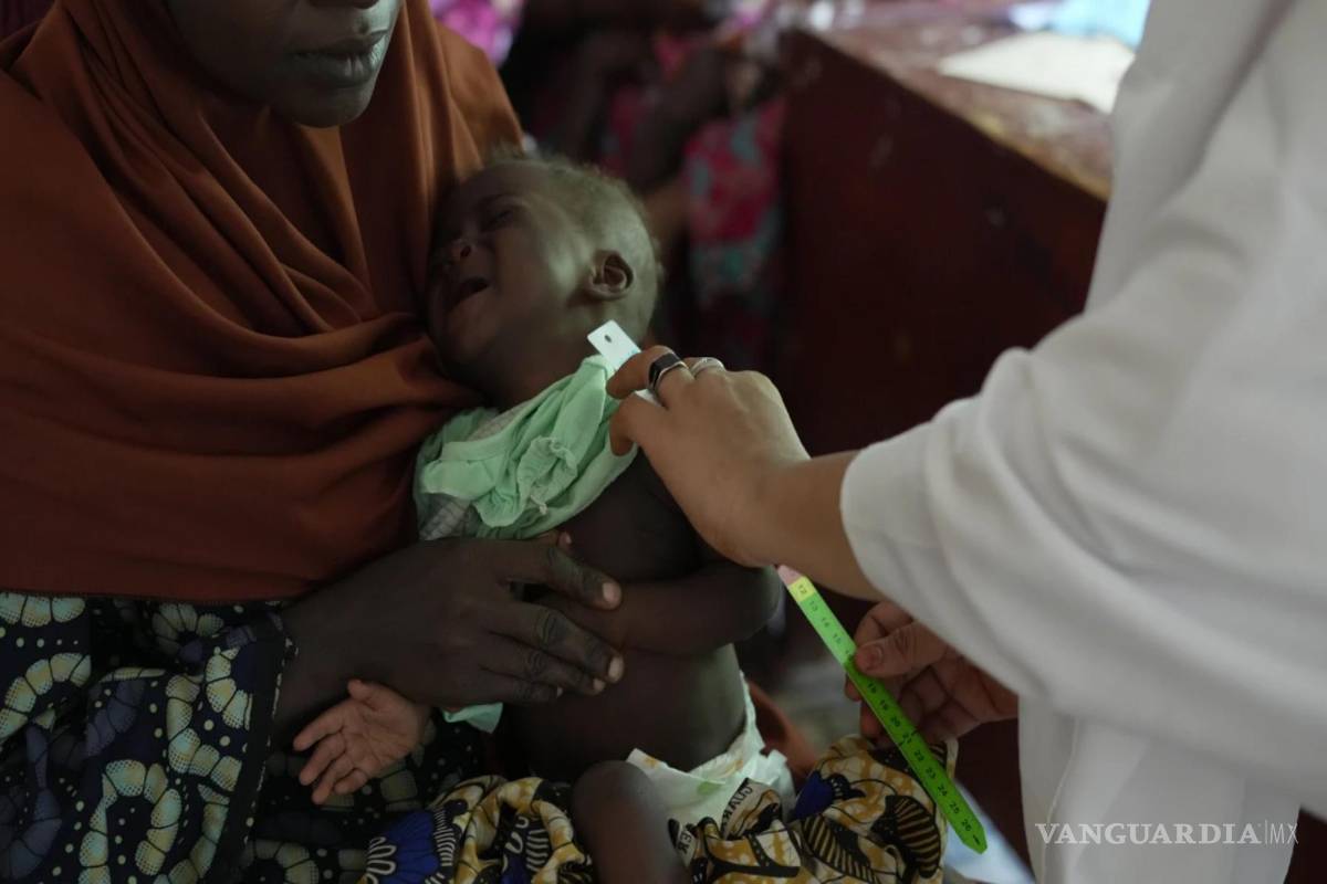 $!Halimah Muhammad, trabajadora de salud local (a la derecha), atiende a un niño que sufre de desnutriciónen el Centro de Salud Primaria de Rumbukawa, en Sokoto.