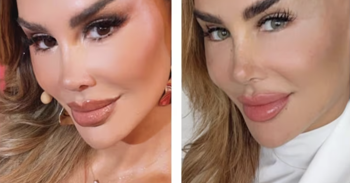 ¿Vale la pena cambiar el color de tus ojos? El peligro real detrás de la cirugía estética