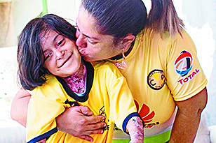 Cantan Las Mañanitas a niña con ‘piel de mariposa’