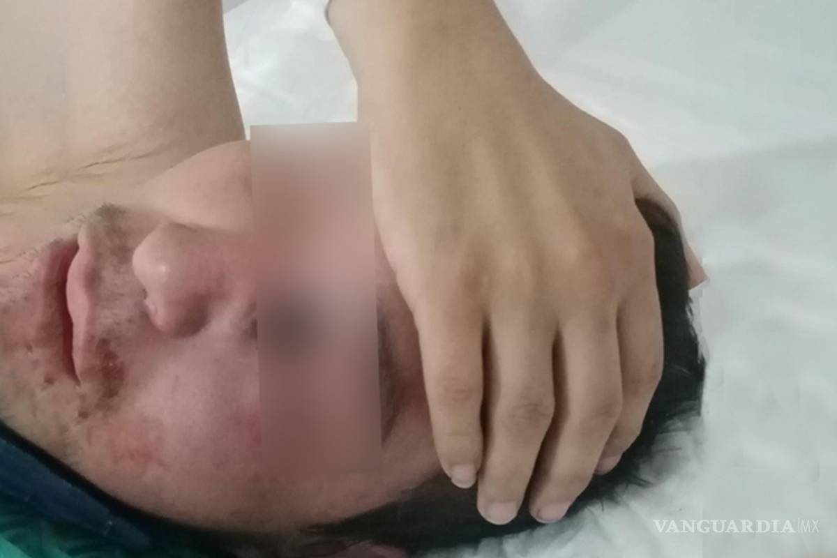 Sin relación con COVID-19 la muerte de Gregorio, paciente con hongo negro: Gatell