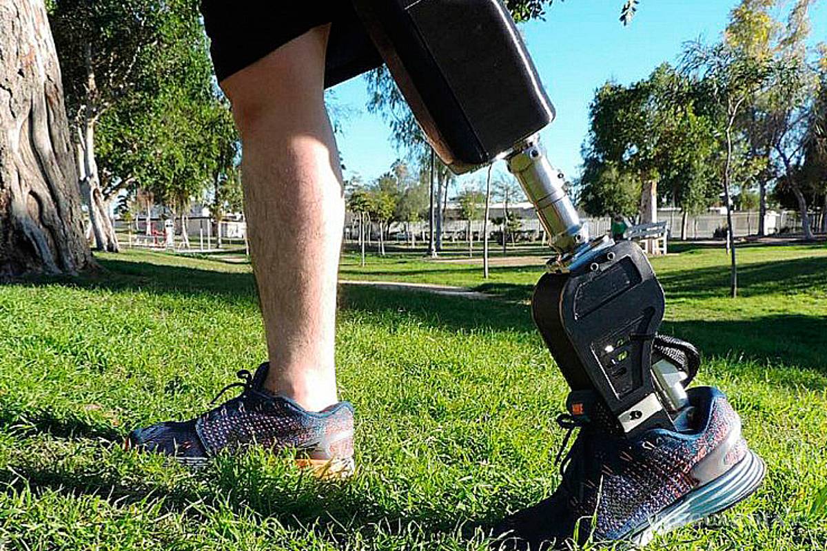 Mexicanos fabrican prótesis biónicas a precios accesibles