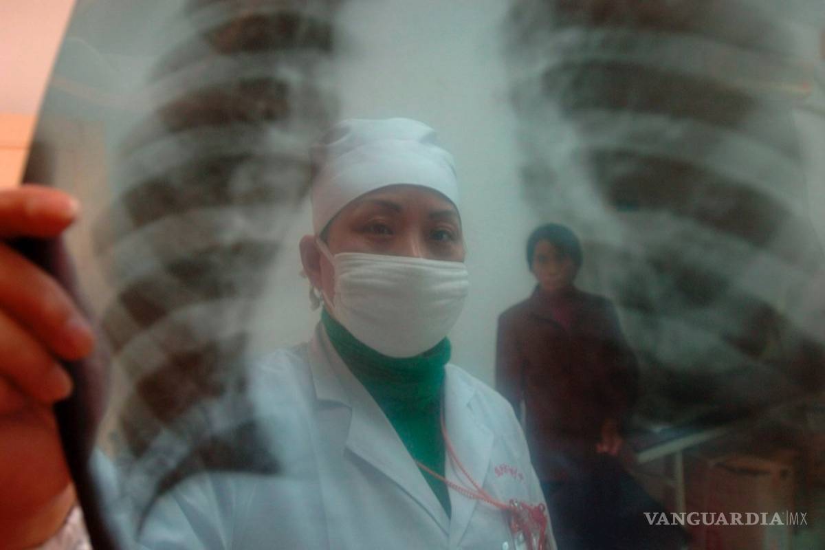 $!¿Sabías que en nuestros pulmones habitan microorganismos que nos protegen del asma?