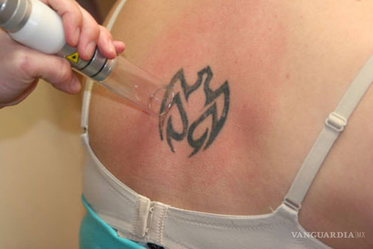 Latinos se borran los tatuajes por miedo a la deportación