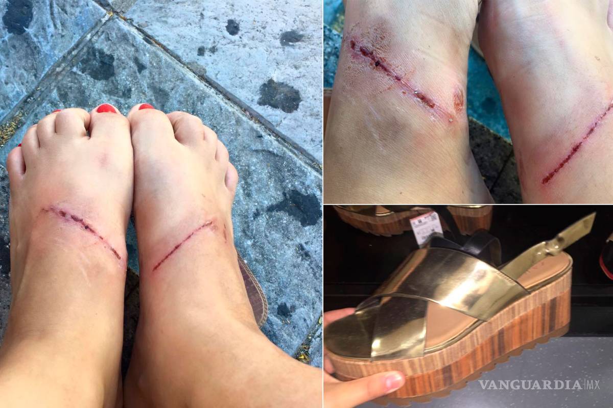 Zara le 'quema' los pies a una mujer