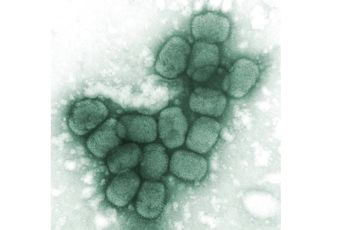 Aprueban en EU medicamento contra la viruela